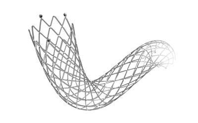 Iliac Vein Stent